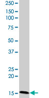 Anti-CIDE C antibody (ab77115) at 1/500 dilution + Hela cell lysate at 25 µgSecondaryGoat anti-Mouse IgG (H&L)-HRP at 1/2500 dilution
