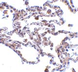 ab5974 at 5µg/ml staining CIKS in human lung tissue by  IHC