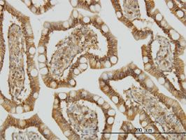 CIKS antibody (ab56758) used in immunohistochemistry at 3ug/ml on formalin fixed and paraffin embedded human small Intestine.