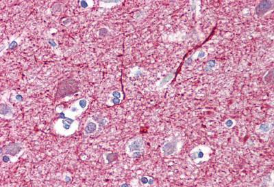 Immunohistochemical analysis of paraffin-embedded Human brain (cortex) tissue labelling 140 kD + 160 kD Neurofilament with ab134278 at 10 &microg/ml. Primary incubation was followed by biotinylated horse anti-mouse IgG secondary antibody, alkaline phosphatase-streptavidin and chromogen.