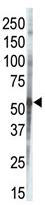 Anti-CKI gamma 3 antibody - Carboxyterminal end (ab37950) at 1/100 dilution + Human placenta lysate