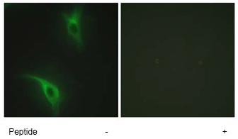 ab72639, at 1/500 dilution, staining CKS1 in HeLa cells by Immunofluorescence in the absence or presence of the immunising peptide.