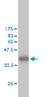 Western blot against tagged recombinant protein immunogen using ab54643 CKS1/CKS2 antibody at 1ug/ml.