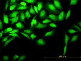 CKS2 antibody (ab54644) used in immunofluorescence at 10ug/ml on HeLa cells.