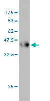 Western blot against tagged recombinant protein immunogen using ab54644 CKS2 antibody at 1ug/ml.