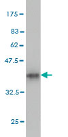 Western blot against tagged recombinant protein immunogen using ab58105 CLASP1 antibody at 1ug/ml.