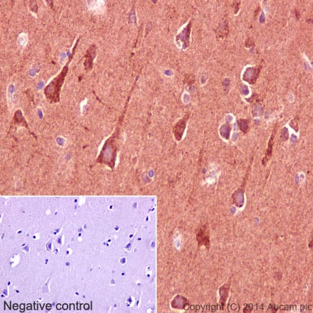 Immunohistochemistry (Formalin/PFA-fixed paraffin-embedded sections) analysis of human cerebral cortex tissue labelling CLASP1 with purified ab108620 at 1/250. Heat mediated antigen retrieval was performed using Tris/EDTA buffer pH 9. ab97051, a HRP-conjugated goat anti-rabbit IgG (H+L) was used as the secondary antibody (1/500). Negative control using PBS instead of primary antibody. Counterstained with hematoxylin.