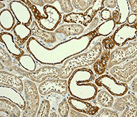 Immunohistochemistry (Formalin/PFA-fixed paraffin-embedded sections) analysis of human kidney tissue labelling CLASP1 with unpurified ab108620 at 1/250.