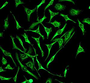Immunocytochemistry/Immunofluorescence analysis of HeLa cells labelling CLASP1 with unpurified ab108620 at 1/100.