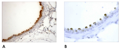 ab59710 at 1/1000, overnight, secondary antibody biotinylated goat anti-sheep at 1/3000.Figure A is a low power image showing intense staining of non-ciliated bronchiolar cells (Clara cells) and lesser staining in alveolar type II cells.Figure B is a higher power image of the staining of the non ciliated bronchiolar cells.