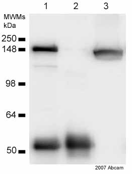 ab21679 immunoprecipitating clathrin heavy chain from human HeLa S3 whole cell lysate (20ug). A protein A matrix was used with the antibody at a concentration of 4ug/mg of lysate. ab21679 was further used in the western blot stage at a dilution of 1/250. The image shows: Lane 1: Clathrin IP (ab21679) Lane 2: Control IP Lane 3: Input (10%)See Abreview