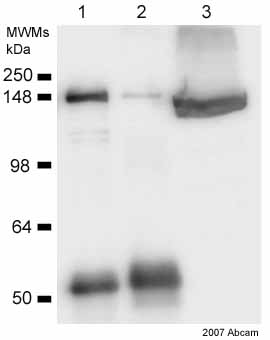 ab21679 immunoprecipitating clathrin heavy chain from rat PC12 whole cell lysate (20ug). A protein A matrix was used with the antibody at a concentration of 4ug/mg of lysate. ab21679 was further used in the western blot stage at a dilution of 1/250. The image shows: Lane 1: Clathrin IP (ab21679) Lane 2: Control IP Lane 3: Input (10%)See Abreview