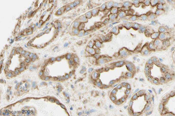 Image courtesy of Human Protein Atlasab21679 staining Clathrin heavy chain in human kidney. Paraffin embedded human (male) kidney tissue was incubated with ab21679 (1/7000 dilution) for 30 mins at room temperature. Antigen retrieval was performed by heat induction in citrate buffer pH 6. ab21679 was tested in a tissue microarray (TMA) containing a wide range of normal and cancer tissues as well as a cell microarray consisting of a range of commonly used, well characterised human cell lines. Further results for this antibody can be found at www.proteinatlas.org