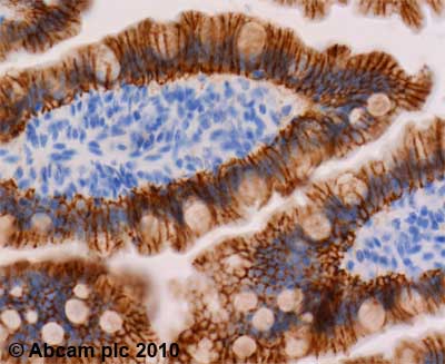 ab15102 (2µg/ml) staining Claudin 3 in human ileum using an automated system (DAKO Autostainer Plus). Using this protocol there is strong membrane staining of the mucosal epithelial cells.Sections were rehydrated and antigen retrieved with the Dako 3 in 1 AR buffer EDTA pH 9.0 in a DAKO PT link. Slides were peroxidase blocked in 3% H2O2 in methanol for 10 mins. They were then blocked with Dako Protein block for 10 minutes (containing casein 0.25% in PBS) then incubated with primary antibody for 20 min and detected with Dako envision flex amplification kit for 30 minutes. Colorimetric detection was completed with Diaminobenzidine for 5 minutes. Slides were counterstained with Haematoxylin and coverslipped under DePeX. Please note that, for manual staining, optimization of primary antibody concentration and incubation time is recommended. Signal amplification may be required.