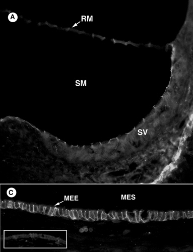 Immunohistochemical analysis of PFA-fixed, paraffin embedded BALB/c murine ear tissue sections. Claudin 3 was stained, using ab15102 at 1/10 dilution, in the inner ear at the organ of Corti, Reissner’s membrane, periosteal lining of otic capsule, and the apical surface of the marginal cells of stria vascularis (upper panel) and in the middle ear intercellular junctions along lateral and basal cell membranes in the mucosal epithelium (lower panel). An AlexaFluor®488-conjugated IgG (1/50) was used as the secondary antibody.