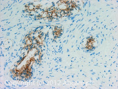 IHC image of Claudin 3 staining in Human normal prostate formalin fixed paraffin embedded tissue section, performed on a Leica BondTM system using the standard protocol F. The section was pre-treated using heat mediated antigen retrieval with sodium citrate buffer (pH6, epitope retrieval solution 1) for 20 mins. The section was then incubated with ab116165, 1µg/ml, for 15 mins at room temperature and detected using an HRP conjugated compact polymer system. DAB was used as the chromogen. The section was then counterstained with haematoxylin and mounted with DPX.For other IHC staining systems (automated and non-automated) customers should optimize variable parameters such as antigen retrieval conditions, primary antibody concentration and antibody incubation times.