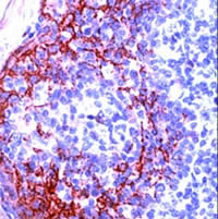 Formalin fixed paraffin embedded human tonsil stained with ab15104 (1:200, 10 min at room temperature).