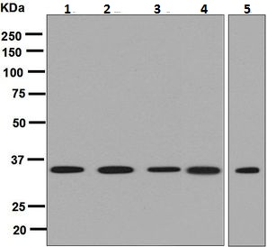 All lanes : Anti-Adenosine A1 Receptor antibody [EPR6179] (ab124780) at 1/1000 dilutionLane 1 : Saos 2 cell lysateLane 2 : SH SY5Y cell lysateLane 3 : Caco 2 cell lysateLane 4 : A549 cell lysateLane 5 : 293T cell lysateLysates/proteins at 10 µg per lane.SecondaryHRP labelled Goat anti Rabbit at 1/2000 dilution