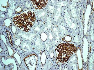 Immunohistochemical analysis of paraffin embedded Human kidney tissue labelling Claudin 5 with ab131259 antibody at 1/100 dilution.