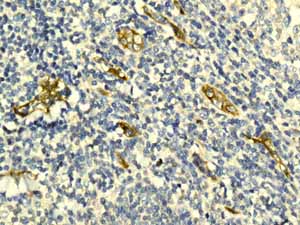 ab131259 showing positive staining in Normal tonsil tissue.
