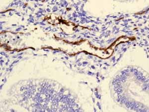 ab131259 showing positive staining in Normal uterus tissue.