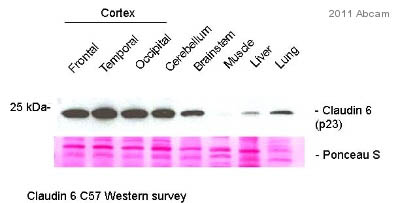 All lanes : Anti-Claudin 6 antibody (ab107059) at 1/1000 dilutionLane 1 : Whole tissue lysate prepared from mouse frontal cortex.Lane 2 : Whole tissue lysate prepared from mouse temporal cortex.Lane 3 : Whole tissue lysate prepared from mouse occipital cortex.Lane 4 : Whole tissue lysate prepared from mouse cerebellum.Lane 5 : Whole tissue lysate prepared from mouse brainstem.Lane 6 : Whole tissue lysate prepared from mouse muscle.Lane 7 : Whole tissue lysate prepared from mouse liver.Lane 8 : Whole tissue lysate prepared from mouse lung.Lysates/proteins at 24 µg per lane.SecondaryGoat anti-rabbit IgG conjugated to HRP at 1/10000 dilutiondeveloped using the ECL technique