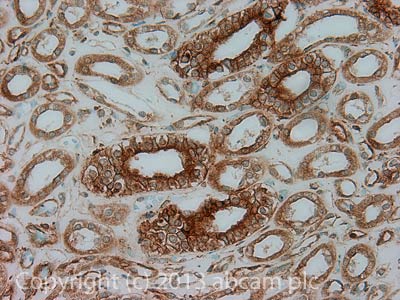 IHC image of Claudin 6 staining in Human normal kidney formalin fixed paraffin embedded tissue section, performed on a Leica BondTM system using the standard protocol F. The section was pre-treated using heat mediated antigen retrieval with sodium citrate buffer (pH6, epitope retrieval solution 1) for 20 mins. The section was then incubated with ab107059, 5µg/ml, for 15 mins at room temperature and detected using an HRP conjugated compact polymer system. DAB was used as the chromogen. The section was then counterstained with haematoxylin and mounted with DPX.For other IHC staining systems (automated and non-automated) customers should optimize variable parameters such as antigen retrieval conditions, primary antibody concentration and antibody incubation times.
