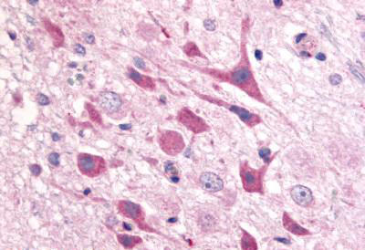 Immunohistochemical analysis of formalin fixed, paraffin embedded Rat brain tissue labelling Adenosine A1 Receptor with ab140706 at 16 µg/ml.