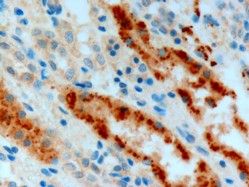 ab40002 at 3ug/ml staining Adenosine A2b receptor in human kidney tissue section by Immunohistochemistry (Formalin/PFA fixed paraffin-embedded sections). Tissue underwent antigen retrieval in microwave with Tris/EDTA buffer (pH 9.0). The HRP staining procedure was used for detection.