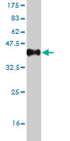 Western blot against tagged recombinant protein immunogen using ab54662 CLCA1 antibody at 1ug/ml.