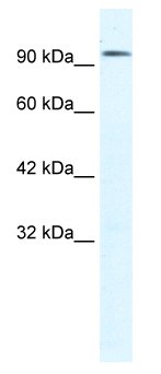Anti-CLCN3 antibody (ab28736) at 1.25 µg/ml + HepG2 cell lysateSecondaryHRP conjugated anti-Rabbit IgG 1: 50,000 - 100,000