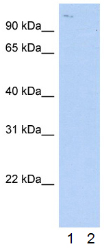 All lanes : Anti-CLCN3 antibody (ab28736) at 2.5 µg/mlLane 1 : HepG2 cell lysateLane 2 : HepG2 cell lysate with blocking peptide at 2 µg/mlLysates/proteins at 25 µg per lane.