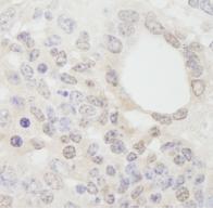 ab84529, at 1/250 dilution, staining cleavage stimulation factor in formalin-fixed, paraffin-embedded mouse teratoma by Immunohistochemistry using DAB staining.