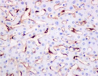 Immunohistochemical analysis of paraffin-embedded Human liver tissue labeling CLEC4G with ab181196 at 1/250 dilution. Secondary antibody: anti rabbit IgG (HRP) prediluted. Counter stained with Hematoxylin.