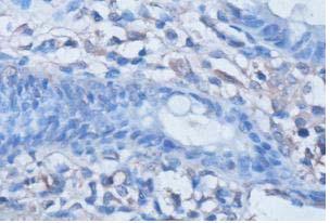 ab101678, at 1/100 dilution, staining membrane Adenosine Receptor A2a in formalin-fixed, paraffin-embedded Human fetal colon tissue, by Immunohistochemistry.