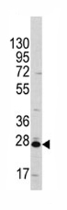 Anti-CLIC1 antibody (ab76592) at 1/60 dilution + A375 cell line lysates at 35 µg