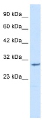 Anti-CLIC2 antibody (ab28687) at 1.25 µg/ml (in 5% skim milk / PBS buffer) + Jurkat cell lysate at 10 µg/mlSecondaryHRP conjugated anti-Rabbit IgG