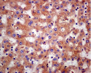 Immunohistochemical analysis of paraffin-embedded Human liver tissue labeling CLIC2 with ab175230 at 1/50 dilution.