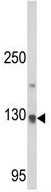 Anti-CLIP170 antibody - N-terminal (ab135738) at 1/100 dilution + Mouse cerebellum tissue lysate at 35 µg
