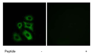 Immunofluorescence analysis of A549 cells using ab74239 at a 1/500 dilution.Left image un-treated.Right image treated with immunizing peptide.