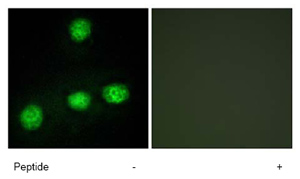 Immunofluorescence analysis of CLK1 in HUVEC cells, using ab74044 at a 1/500 dilution.Left image: untreated.Right image: treated with immunizing peptide.