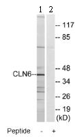 All lanes : Anti-CLN6 antibody (ab75007) at 1/500 dilutionLane 1 : extracts from HeLa cellsLane 2 : extracts from HeLa cells with immunising peptide at 10 µgLysates/proteins at 30 µg per lane.