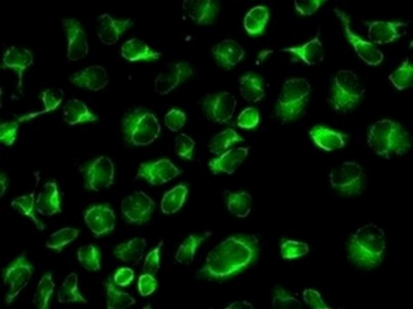 Immunofluorescent staining of HeLa cells labelling CLPTM1 with ab133756 at 1/250.