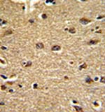 Immunohistochemical analysis of formalin-fixed and paraffin-embedded human brain tissue stained with ab135587 at 1/50 dilution. The antibody was peroxidase-conjugated to the secondary antibody, followed by DAB staining.