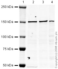 Lane 1 :  MarkerLanes 2 - 4 :  Anti-CNAP1 antibody (ab34338) at 1 µg/mlLane 1 : As aboveLane 2 : HeLa (Human epithelial carcinoma cell line) Whole Cell Lysate at 10 µgLane 3 : Jurkat (Human T cell lymphoblast-like cell line) Whole Cell Lysate (ab7899) at 20 µgLane 4 : A431 (Human epithelial carcinoma cell line) Whole Cell Lysate (ab7909) at 20 µgSecondaryLanes 2 - 4 : IR Dye 680 Conjugated Goat Anti-Rabbit IgG (H+L) at 1/15000 dilutionPerformed under reducing conditions.