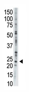 Anti-Adenylate Kinase 1 antibody - C-terminal (ab71621) at 1/100 dilution + CHO cell lysate at 12.5 µg