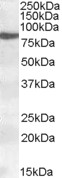 Anti-15 Lipoxygenase 1 antibody (ab80495) at 0.2 µg/ml + nuclear HeLa cell lysate (in RIPA buffer) at 35 µg