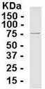 Anti-ADFP antibody (ab37516) at 1/2000 dilution + E. coli-derived fusion protein at 2.5 µgSecondaryGoat anti-IgY-HRP at 1/1000 dilution
