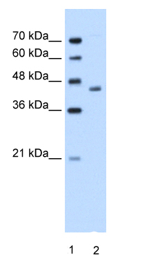 Anti-ADH1B antibody (ab58647) at 1.25 µg/ml + Jurkat cell lysate at 10 µgSecondaryHRP conjugated anti-Rabbit IgG at 1/50000 dilution