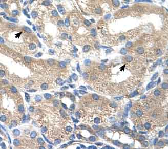 Immunohistochemistry (Formalin/PFA-fixed paraffin-embedded sections) analysis of human kidney tissue labelling ADH1B with ab58647 at 4-8µg/ml. Arrows indicate positively labelled epithelial cells of the renal tubules. Magnification: 400X.